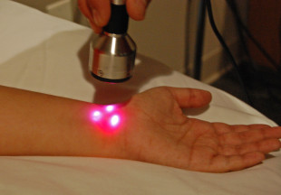 Laser Carpal tunnel 080913